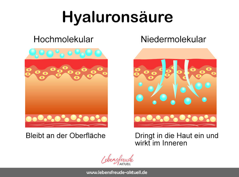 Hyaluronsäure Niedermolekular Hochmolekular